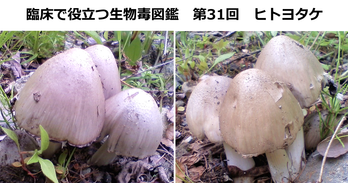第31回　ヒトヨタケ　<br>上條 吉人（埼玉医科大学特任教授・臨床中毒学講座 / 同大学病院臨床中毒センター長）