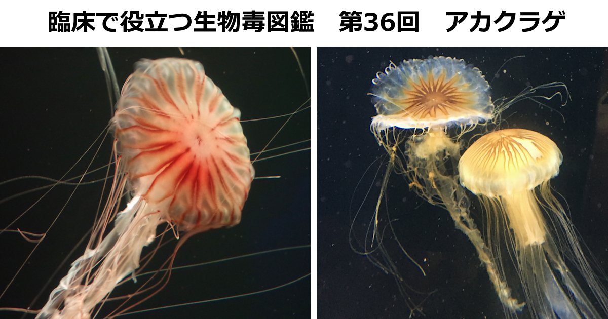 第36回　アカクラゲ　 上條 吉人（埼玉医科大学特任教授・臨床中毒学講座 / 同大学病院臨床中毒センター長）