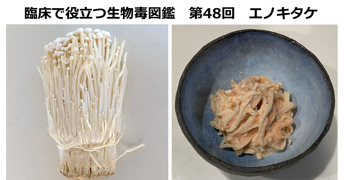 第48回　エノキタケ　 上條 吉人（埼玉医科大学特任教授・臨床中毒学講座 / 同大学病院臨床中毒センター長）